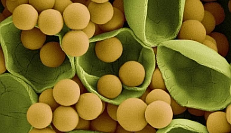 Foto: Karen Köhler / Max-Planck-Institut für Kolloid- und Grenzflächenforschung